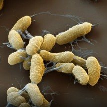 Doenças da Idade Média continuam circulando, e fazendo vítimas - Opas/Reprodução