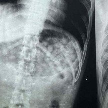 Homem em saída temporária vomita maconha em ônibus e é preso por tráfico - Divulgação/PMMG