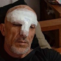 Coincidência? Irmão Cravinhos sofre acidente perto do local do crime