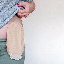 SUS realizou mais de 110 mil cirurgias de ostomia nos últimos dez anos - Freepik