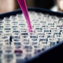 Estudo mostra que inflamação no cérebro pode ser chave do Alzheimer - Louis Reed/ Unsplash