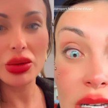Andressa Urach se arrepende da mudança de cor dos olhos - Montagem/Reprodução/Redes Sociais 