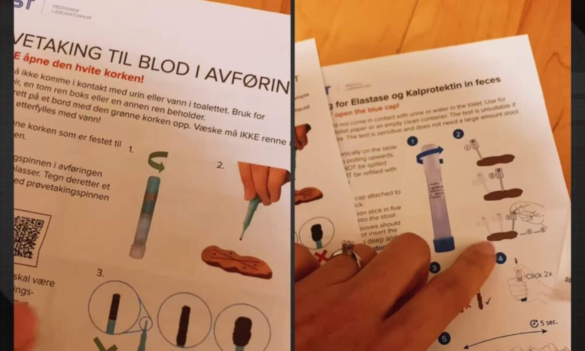 Brasileira mostra como funciona exame de fezes na Noruega e viraliza - Tupi