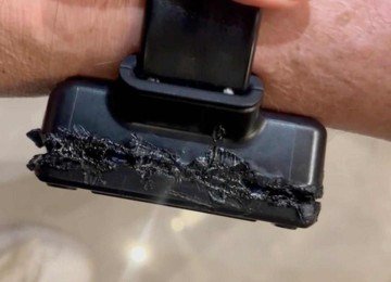 Tornozeleira de Bolsonaro foi queimada com solda de ferro  -  (crédito: Platobr Politica)