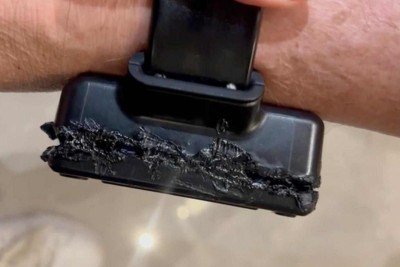 Tornozeleira de Bolsonaro foi queimada com solda de ferro  -  (crédito: Platobr Politica)