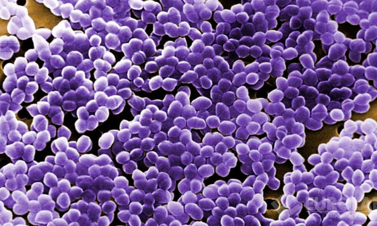 Derek tinha enterococos resistentes à vancomicina e outras bactérias igualmente resistentes -  (crédito: Eurolab.net/Reprodução)