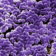 Resistência microbiana, humildade e canja de galinha  - Eurolab.net/Reprodução