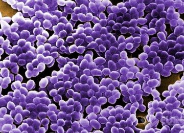 Derek tinha enterococos resistentes à vancomicina e outras bactérias igualmente resistentes -  (crédito: Eurolab.net/Reprodução)