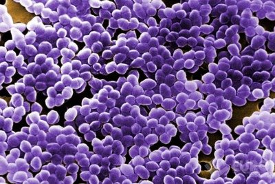 Derek tinha enterococos resistentes à vancomicina e outras bactérias igualmente resistentes -  (crédito: Eurolab.net/Reprodução)