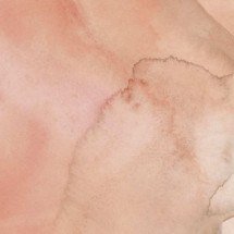 Como alguns tipos de câncer de mama "driblam" o tratamento? - Sandra Jávera/Pesquisa FAPESP