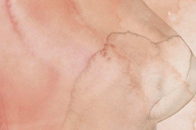 A proteína HER2 é alvo de medicamentos avançados contra a doença -  (crédito: Sandra Jávera/Pesquisa FAPESP)