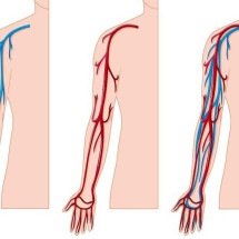 Cirurgia vascular: hospital de BH recebe evento de atualização científica - brgfx/FreePik