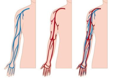 O evento inclui procedimentos como endolaser, radiofrequência, laser transdérmico e escleroterapia com espuma -  (crédito: brgfx/FreePik)