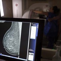 Medo, dor, vergonha e desigualdades afastam mulheres de rastrear câncer - Jos&eacute; Cruz/Ag&ecirc;ncia Brasil