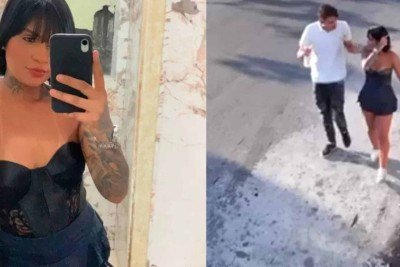 Tainara Souza Santos passou por cirurgias e teve as pernas amputadas devido à extensão das lesões -  (crédito: Reprodução)