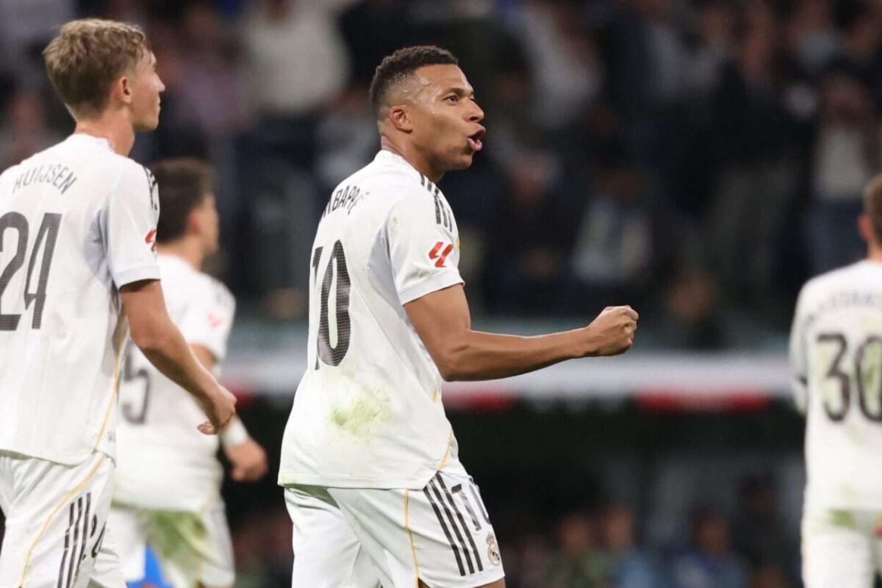 Mbappé pode jogar contra o City com dedo fraturado