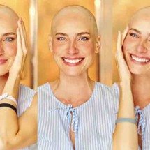 Atriz descobre câncer após viver personagem com a mesma doença em filme -  Reprodução do Instagram @danigondim1