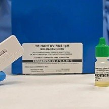 Novo teste faz diagnóstico de hantavirose em 20 minutos