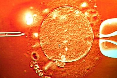 Até 20% do esperma do doador contém a mutação perigosa que aumenta o risco de câncer (imagem ilustrativa) -  (crédito: Getty Images)