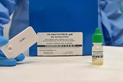 Produto desenvolvido pela Fiocruz e UFRJ obteve registro da Anvisa -  (crédito: Rudson Amorim/IOC/Fiocruz)