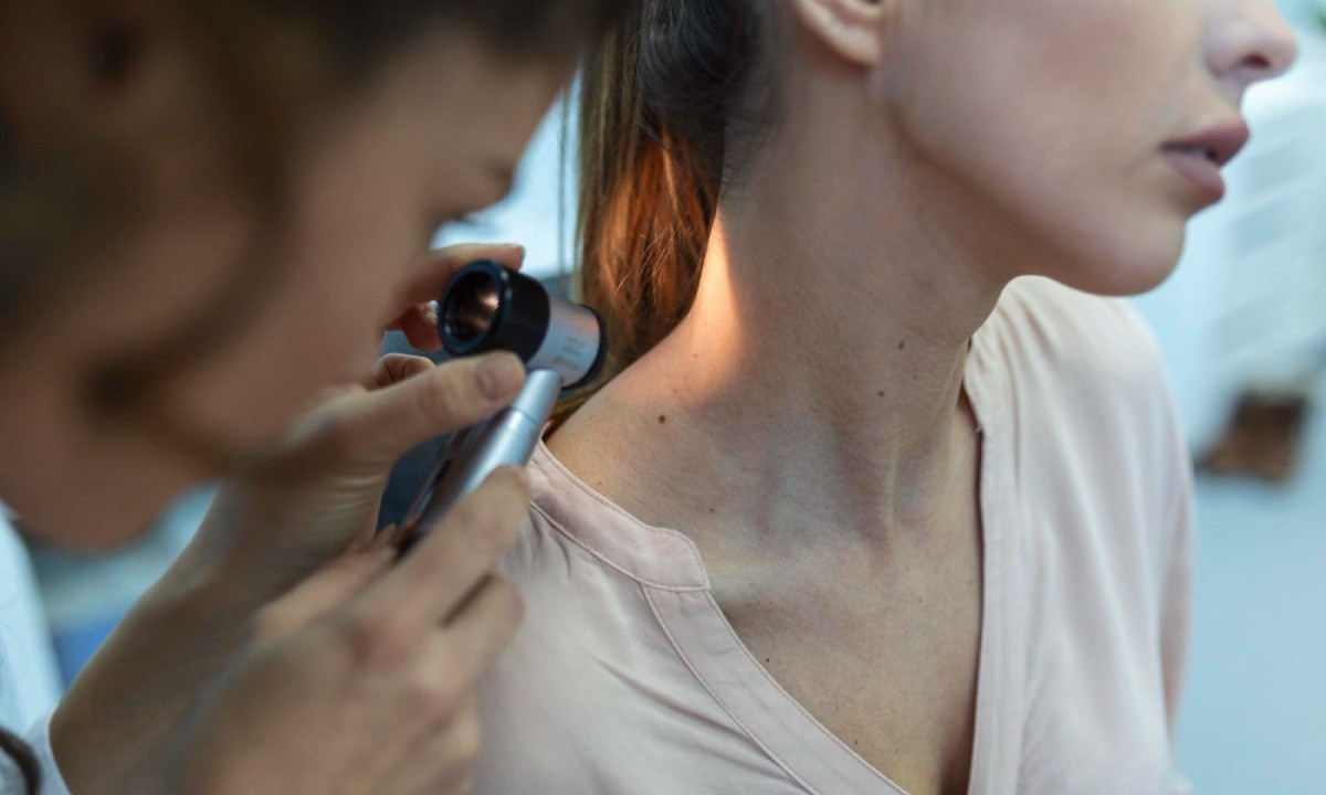 Quando identificado no início, o melanoma pode ser removido em um procedimento rápido, diz cirurgião oncológico - (crédito: stefamerpik/FreePik)
