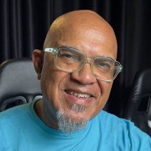 Pioneiro do punk faz cirurgia cardíaca de emergência antes de show - Instagram/Reprodu&ccedil;&atilde;o