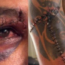 Chuva em BH: amigos criam vaquinha para motoboy atingido por poste - Redes sociais/reprodução