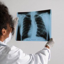 Doenças pulmonares: uso de IA no raio-x acelera diagnóstico - FreePik