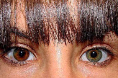 Você já ouviu falar em heterocromia? Trata-se de uma condição em que uma pessoa apresenta diferença de cor nas íris dos olhos.  -  (crédito:  Xavier Nájera/Wikimédia Commons)
