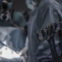 Transplante de órgãos exige tratamento a longo prazo, lembra especialista  - Piron Guillaume Unsplash