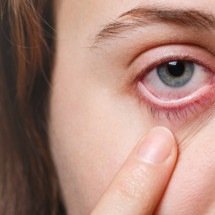 4 dicas para evitar acidentes oculares nas festas de fim de ano - Freepik