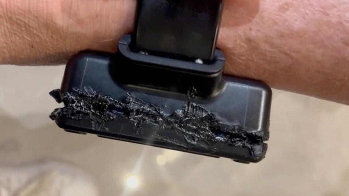 O rompimento f&iacute;sico da tornozeleira eletr&ocirc;nica &eacute; uma das principais vulnerabilidades do sistema de monitoramento -  (crédito: Platobr Politica)