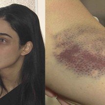 Economista que agrediu empresária tem histórico violento: "Vou te aleijar" - TV Alterosa