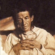 Mundo em alerta sobre Mal de Alzheimer: em 2050, doença deve afetar 139 milhões de pessoas - Domínio público 