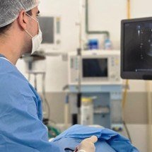 Ablação de nódulo na tireoide: entenda o procedimento - Arquivo pessoal