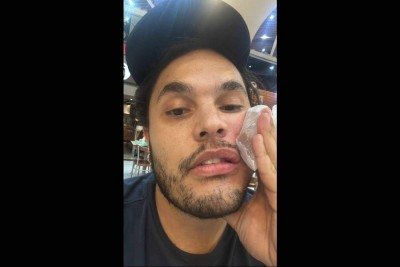 Israel Borges foi vitima de agressões e homofobia ao defender o pai de uma atitude racista praticada por um segurança -  (crédito: Arquivo pessoal)