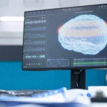 Após AVC: a neuromodulação e a fisioterapia para reabilitar pacientes  - Imagem: DC Studio/Freepik