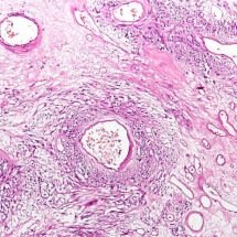 Avaliação oncogenética nos cânceres digestivos em jovens  - 	CoRus13/wikimedia commons