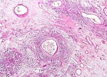 Imagem de exame de tumor cancerígeno gastrointestinal -  (crédito: 	CoRus13/wikimedia commons)