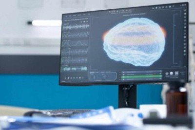 Os procedimentos são considerados totalmente seguros e também têm sido usados em tratamentos para depressão, ansiedade e dor crônica  -  (crédito: Imagem: DC Studio/Freepik)