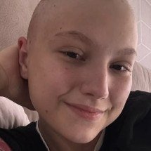 Linfoma de Hodgkin: câncer que matou Isabel Veloso também causou morte de ginasta de 18 anos - Reproduc?a?o/Instagram