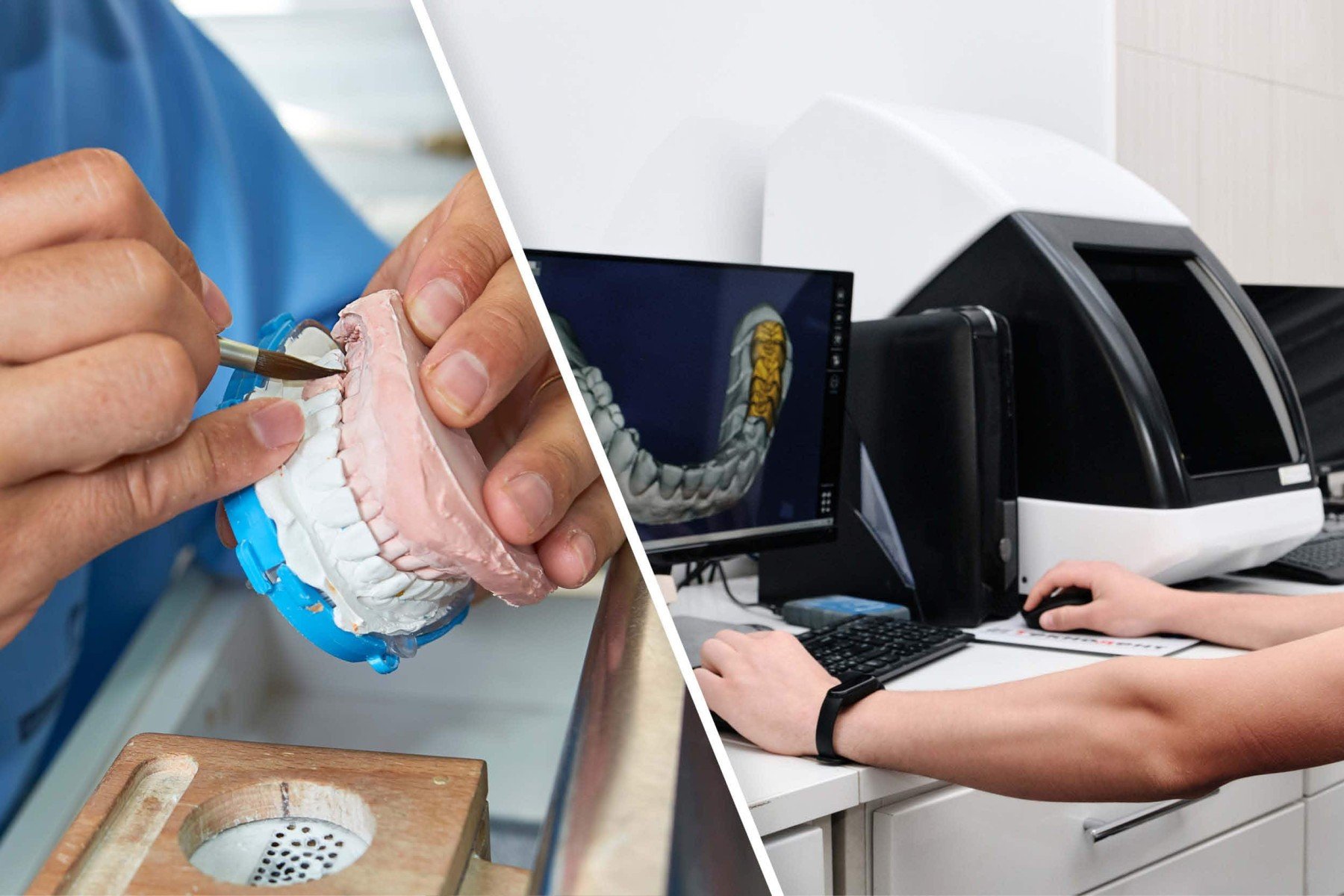 Brasil registra 25 mil técnicos em prótese dentária digital - DINO