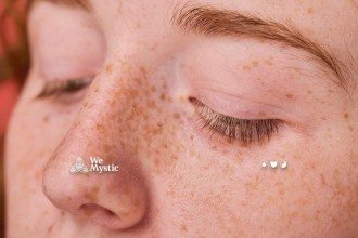 Você tem pintas no rosto? Conheça os significados, segundo a fisiognomia chinesa