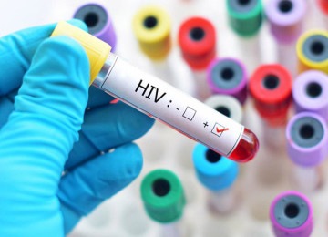 A aprovação pela Anvisa se limita à prevenção da infecção pelo HIV-1, não sendo aplicada à variante HIV-2. - (crédito: PRess Serbia - Flickr) A aprovação pela Anvisa se limita à prevenção da infecção pelo HIV-1, não sendo aplicada à variante HIV-2. - (crédito: PRess Serbia - Flickr)