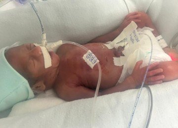 Beb&ecirc; 'milagre' e m&atilde;e sobrevivem ap&oacute;s parto em casa aos 6 meses de gravidez -  (crédito: &Aacute;lbum de fam&iacute;lia)