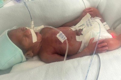 Beb&ecirc; 'milagre' e m&atilde;e sobrevivem ap&oacute;s parto em casa aos 6 meses de gravidez -  (crédito: &Aacute;lbum de fam&iacute;lia)