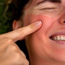 Para minimizar esses efeitos, especialistas recomendam o uso de barreiras físicas e químicas -  (crédito: Freepik)