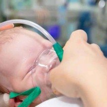 Crianças de até 2 anos, especialmente as recém-nascidas, são as principais vítimas da bronquiolite, que tem entre suas causas a infecção pelo sincicial

 -  (crédito: saude.mg.gov.br/Reprodução)