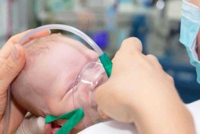 Crianças de até 2 anos, especialmente as recém-nascidas, são as principais vítimas da bronquiolite, que tem entre suas causas a infecção pelo sincicial

 -  (crédito: saude.mg.gov.br/Reprodução)