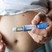 Estudo mostra rapidez com que se recupera peso após fim do uso de medicamentos para emagrecer - ???? ?????